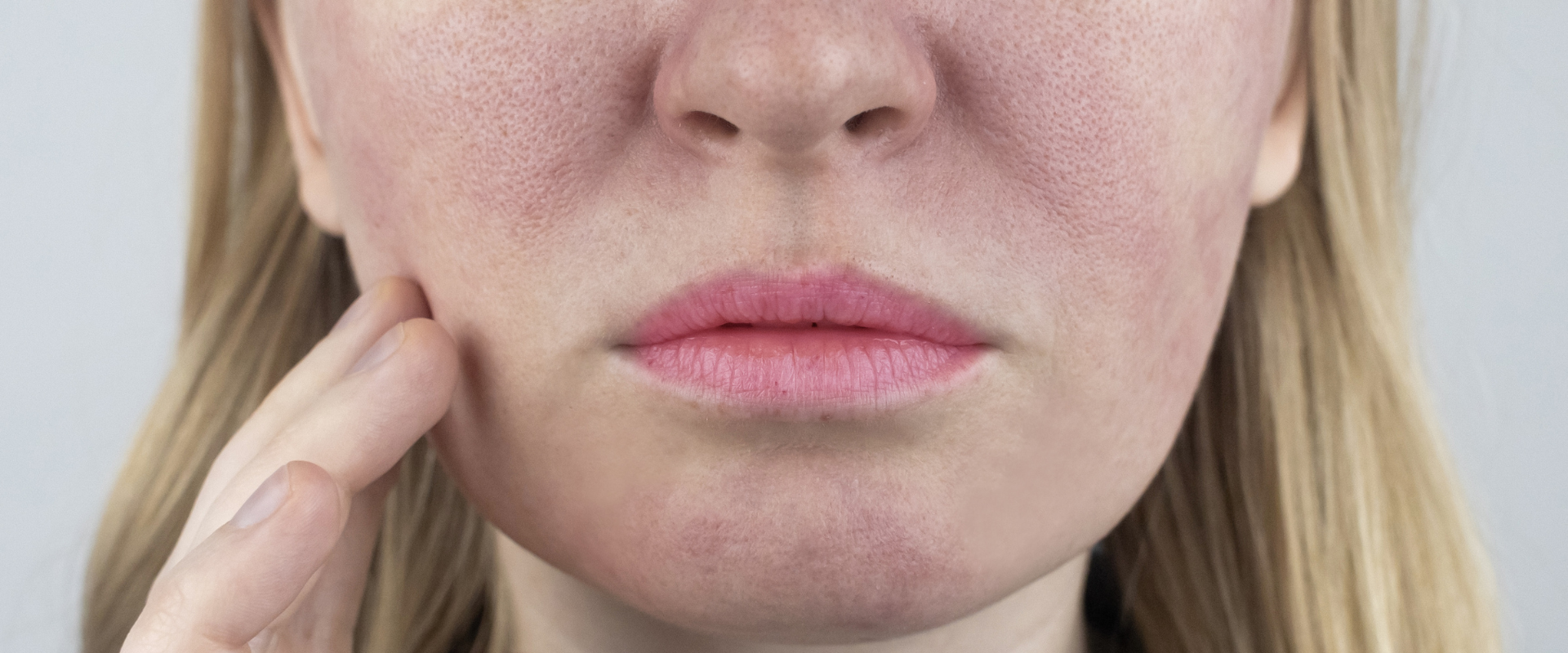 quelques rougeurs sur la peau d'une femme
